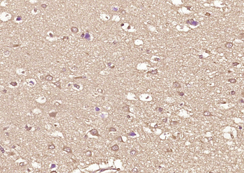 JNK1 + JNK3 Rabbit Polyclonal Antibody