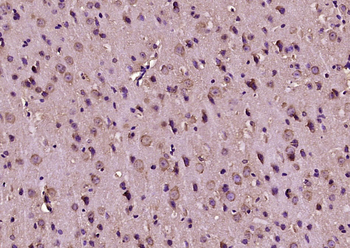 JNK1 + JNK3 Rabbit Polyclonal Antibody