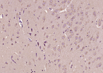 JNK1 + JNK3 Rabbit Polyclonal Antibody