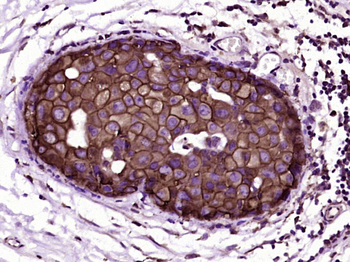 C-erbB-2/HER2 Mouse Monoclonal Antibody