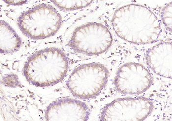 C-erbB-2/HER2 Mouse Monoclonal Antibody