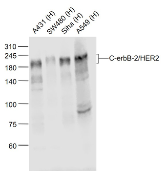 C-erbB-2/HER2 Mouse Monoclonal Antibody