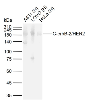 C-erbB-2/HER2 Mouse Monoclonal Antibody