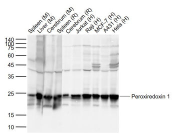 Peroxiredoxin 1 Mouse Monoclonal Antibody
