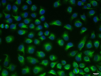 ATG5/APG5L Mouse Monoclonal Antibody