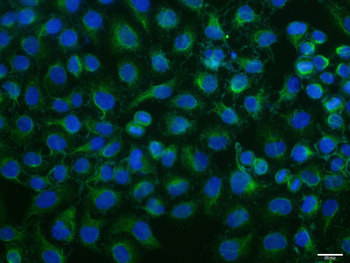 ATG5/APG5L Mouse Monoclonal Antibody
