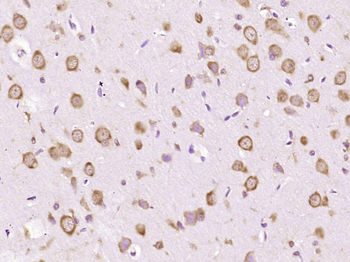 ATG5/APG5L Mouse Monoclonal Antibody