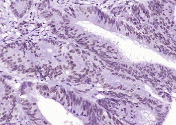 XRCC4 Mouse Monoclonal Antibody