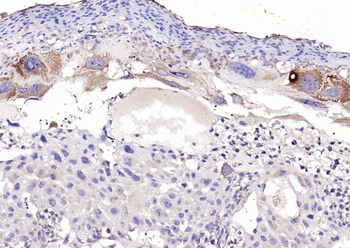 Phospho-PERK (Thr982) Rabbit Polyclonal Antibody