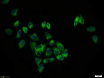 Phospho-PERK (Thr982) Rabbit Polyclonal Antibody
