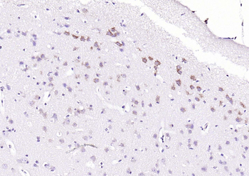 Phospho-PERK (Thr982) Rabbit Polyclonal Antibody