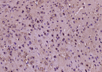 Phospho-PERK (Thr982) Rabbit Polyclonal Antibody