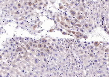 Phospho-PERK (Thr982) Rabbit Polyclonal Antibody