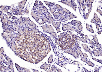 Phospho-PERK (Thr982) Rabbit Polyclonal Antibody