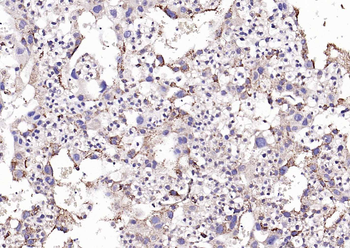 Phospho-PERK (Thr982) Rabbit Polyclonal Antibody