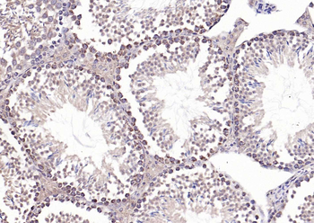 Phospho-PERK (Thr982) Rabbit Polyclonal Antibody