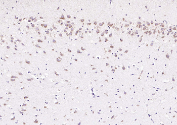 Phospho-PERK (Thr982) Rabbit Polyclonal Antibody