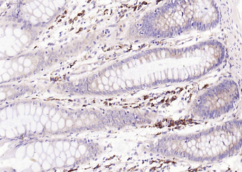 Phospho-PTEN (Ser380) Recombinant Rabbit Monoclonal Antibody
