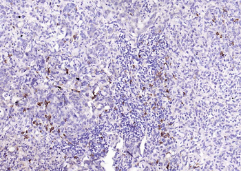 Phospho-PTEN (Ser380) Recombinant Rabbit Monoclonal Antibody