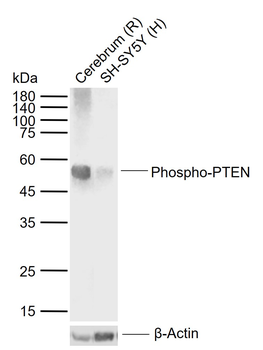 Phospho-PTEN (Ser380) Recombinant Rabbit Monoclonal Antibody