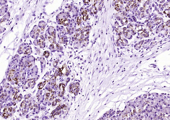 SOD2 Mouse Monoclonal Antibody