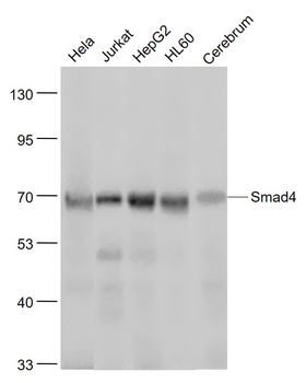 Smad4 Recombinant Rabbit Monoclonal Antibody