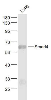 Smad4 Recombinant Rabbit Monoclonal Antibody