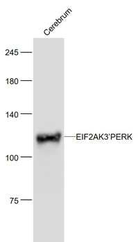 EIF2AK3/PERK Mouse Monoclonal Antibody
