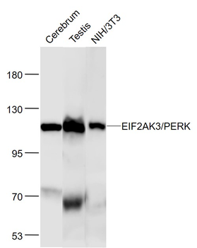 EIF2AK3/PERK Mouse Monoclonal Antibody