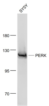 EIF2AK3/PERK Mouse Monoclonal Antibody