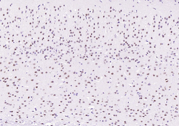 Phospho-STAT3 (Ser727) Recombinant Rabbit Monoclonal Antibody
