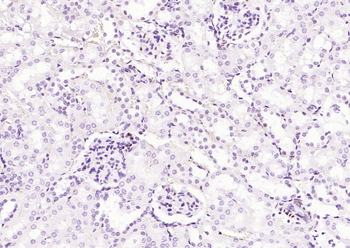 Phospho-STAT3 (Ser727) Recombinant Rabbit Monoclonal Antibody