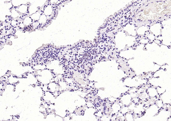 Phospho-STAT3 (Ser727) Recombinant Rabbit Monoclonal Antibody