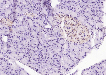 Phospho-STAT3 (Ser727) Recombinant Rabbit Monoclonal Antibody