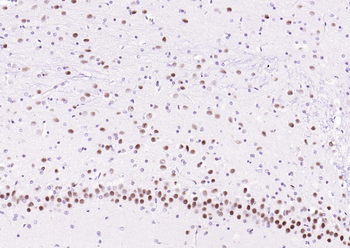 Phospho-STAT3 (Ser727) Recombinant Rabbit Monoclonal Antibody