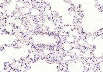 Phospho-STAT3 (Ser727) Recombinant Rabbit Monoclonal Antibody