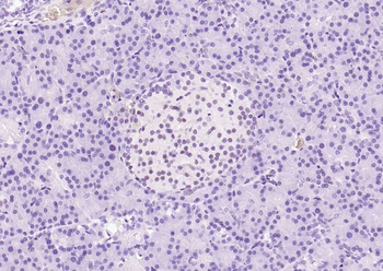 Phospho-STAT3 (Ser727) Recombinant Rabbit Monoclonal Antibody