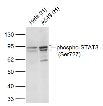 Phospho-STAT3 (Ser727) Recombinant Rabbit Monoclonal Antibody