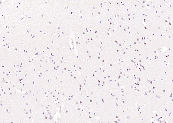 Phospho-STAT3 (Ser727) Recombinant Rabbit Monoclonal Antibody