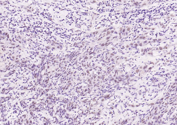 Phospho-STAT3 (Ser727) Recombinant Rabbit Monoclonal Antibody