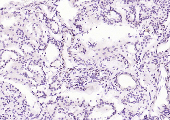 Phospho-STAT3 (Ser727) Recombinant Rabbit Monoclonal Antibody