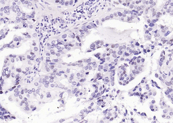 Phospho-STAT3 (Ser727) Recombinant Rabbit Monoclonal Antibody