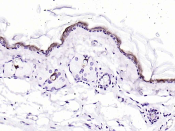 CK10/Cytokeratin 10 Recombinant Rabbit Monoclonal Antibody