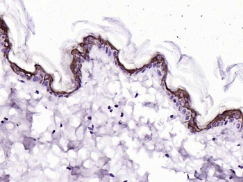 CK10/Cytokeratin 10 Recombinant Rabbit Monoclonal Antibody