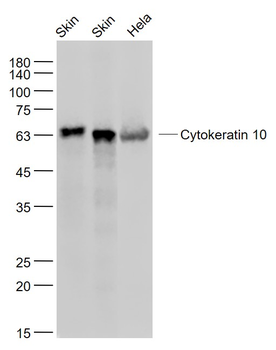 CK10/Cytokeratin 10 Recombinant Rabbit Monoclonal Antibody
