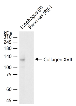 Collagen XVII Recombinant Rabbit Monoclonal Antibody
