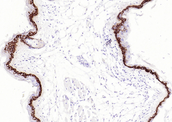 Collagen XVII Recombinant Rabbit Monoclonal Antibody