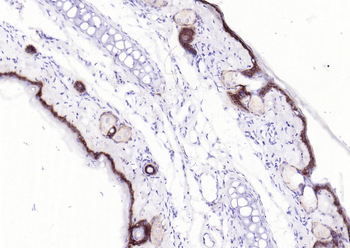 Collagen XVII Recombinant Rabbit Monoclonal Antibody