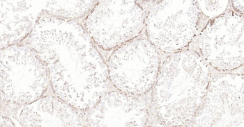 IRF3 Recombinant Rabbit Monoclonal Antibody
