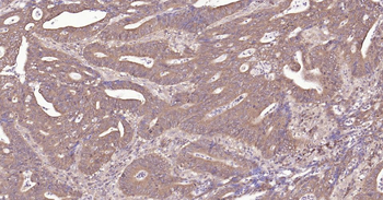 IRF3 Recombinant Rabbit Monoclonal Antibody